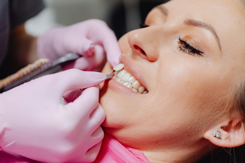 FOTO: https://www.pexels.com/photo/a-dentist-applying-a-veneer-tooth-on-a-patient-6627571/