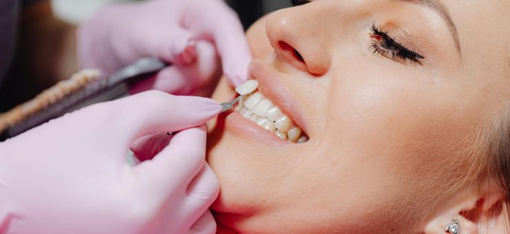 FOTO: https://www.pexels.com/photo/a-dentist-applying-a-veneer-tooth-on-a-patient-6627571/